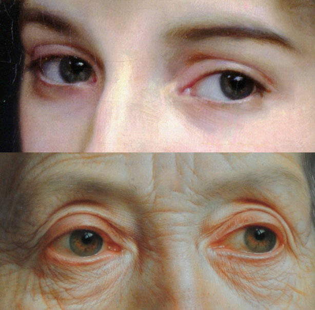 young_and_old_sclera